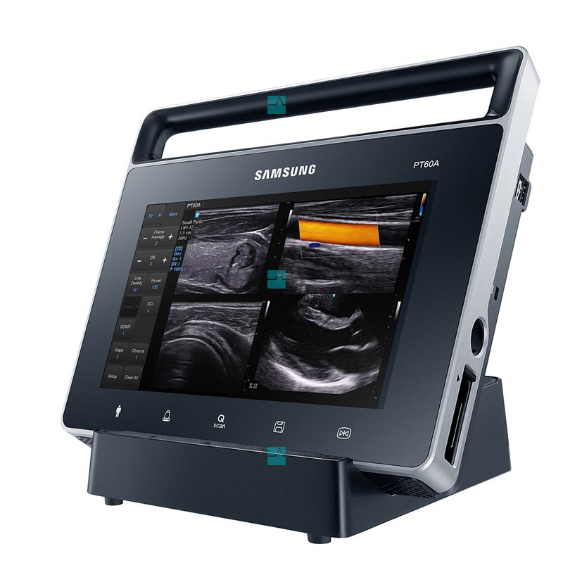 Samsung Medison PT60 – изображение 2